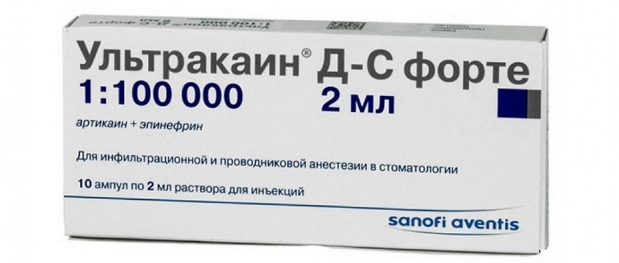 40мг/мл+0,005 мг/мл картридж 1,7мл №100. Ультракаин раствор для инъекций. Ультракаин д-с ампулы 2мл №10. Анестезия в стоматологии препараты ультракаин. Ампула ультракаин применение.