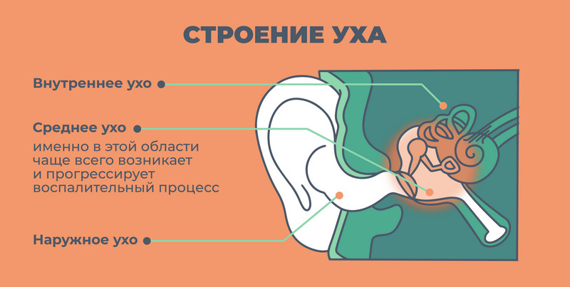 Продуло ухо: первая помощь при болях и чем лечить в домашних условиях