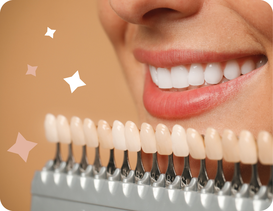 Отбеливание зубов: ослепительная улыбка без вреда для эмали?